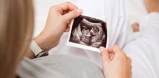 Prosedur aborsi biasanya tergantung usia janin kehamilan anda. Cara Mengubur Janin Usia 2 Bulan Menurut Agama Islam Wajib Tahu Theasianparent Indonesia