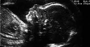 Par ce stade de la grossesse tardif, le système nerveux du bébé est en pleine maturité. Video L Echographie A 33 Semaines De Grossesse Magicmaman Com