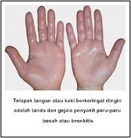 Mengetahui saat yang tepat untuk melakukan pengobatan medis. Pusat Obat Denature Cara Menyembuhkan Penyakit Paru Paru Basah