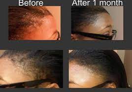 You must have spent hundreds and even thousands of dollars on hair shampoos and you will be surprised to find that after you apply the oil on your hair after shampooing, the drying takes lesser time. Regular Use Of Wild Growth Hair Oils Wild Growth Hair Oil Kenya Original Facebook