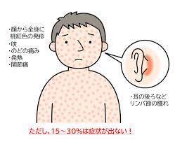 風疹｜原因・症状・対処法・予防法｜大正健康ナビ｜大正製薬 さん