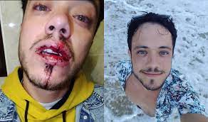 His boyfriend meets his boyfriend. Gang Attack Man With Steel Bars For Kissing His Boyfriend Goodbye