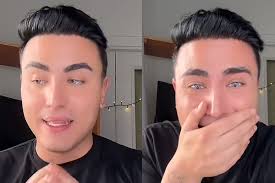 Lucky John, quanto è costata l'operazione agli occhi? La cifra!