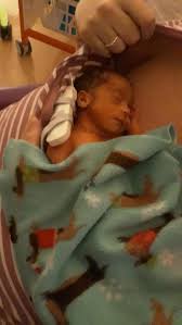 Back pain usually happens earlier if it's not your first baby because weaker abdominal muscles put. Mum Praises Worcester Hospital After Twins Born 10 Weeks Early During Coronavirus Crisis Worcester News