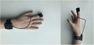 Image result for Capillary Refill