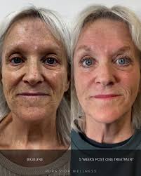 Rebecca Sandor Hammermeister (@hammerfit_aesthetics) • Instagram photos and  videos