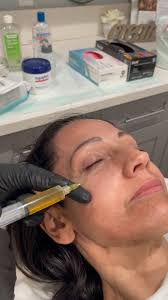 Dark circles who?…, PRP therapy uses your body’s own healing power to  brighten, firm, and refresh the delicate under-eye area—naturally. 💉✨, Say  goodbye to dark circles and hello to radiant eyes., ...