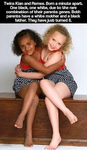 A Rare And Special Combination Of Genes Twins Black Fathers Beautiful Children