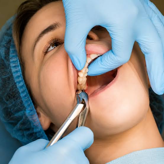Dental care related to Wisdom Tooth Care