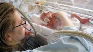How Long Your Premature Baby Will Stay In The Nicu And