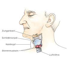 Stimmbandpolypen Polypen Der Stimmbander Eesom Gesundheitsportal