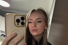 I have one of the worst cases of sweating docs have ever seen