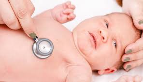 Marfan Syndrome In Children Johns Hopkins Medicine