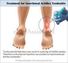 Maybe you would like to learn more about one of these? How To Treat An Achilles Tendon