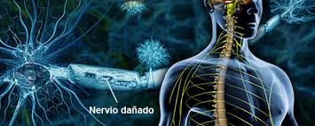 Typically, both sides of the body are involved, and the initial symptoms are changes in sensation or pain often in the back along with muscle weakness. Sorpresa Sindrome De Guillain Barre Tambien Estaria Asociado A Cirugias Previas Cluster Salud Americaeconomia