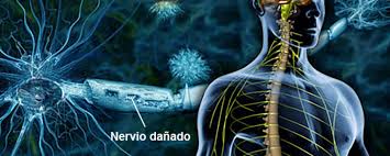 Este texto fue publicado inicialmente en. Sorpresa Sindrome De Guillain Barre Tambien Estaria Asociado A Cirugias Previas Cluster Salud Americaeconomia