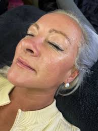 Last minute space today if anyone wants anything 🫶🏻 Basic dermaplane