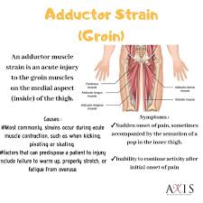 A pulled muscle may feel sore or painful and restrict movement. Groin Strain A Axis Physiotherapy Fitness Studio Facebook