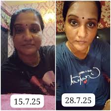 Weight Loss Journey with Herbalife Shakes and Exercise