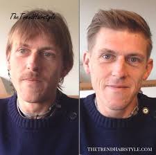 Here's another timeless scissor cut that can also benefit men with receding hairlines or thinning hair. Short Combover With Temple Fade 50 Classy Haircuts And Hairstyles For Balding Men The Trending Hairstyle