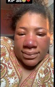 Pls for the sake of all the pregnant women I want to plead and also  apologize to anyone that might take dis the other way round am sorry about  what am about