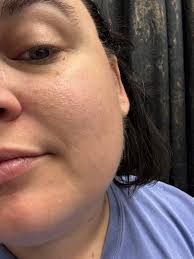 Highly recommended skincare and wellness services in Suntree