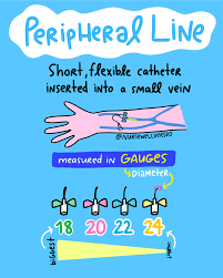Image result for Peripheral IV Access