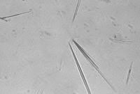 Microscopic Urinalysis Part 2 Crystals And Casts Monosodium Urate Crystals Usually Precipi Medical Laboratory Science Medical Laboratory Laboratory Science