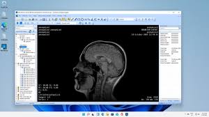 Maybe you would like to learn more about one of these? Ciuslwhdgtfeqm