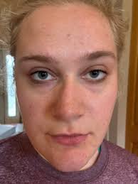 Stop shaving! Here's how to permanently get rid of facial, body and pubic  hair 🔴 We are removing inactive members from here. If you want to keep  getting our recipes say something.😀