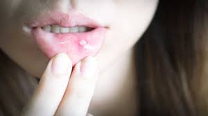 We did not find results for: Atasi Nyeri Sariawan Dengan Bahan Bahan Herbal Berikut Ini Kumparan Com