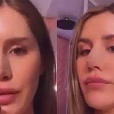 Candelaria tinelli antes y después. Mica Tinelli Se Opero La Nariz Y Sufrio Una Complicacion Diarioshow El Portal De Espectaculo