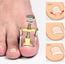 Alhamdulillah, setelah mengurut sakit terus berkurangan sebanyak 70%, dan keesokan harinya sakit telah hilang sepenuhnya. 7 Tips Yang Perlu Kamu Ketahui Untuk Mengobati Cantengan Pada Kuku Jari Tangan Ataupun Kaki