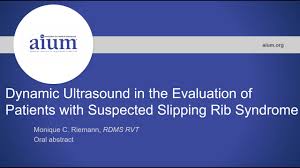 Dynamic Ultrasound In The Evaluation Of Patients With Suspected Slipping Rib Syndrome Part 2 Youtube