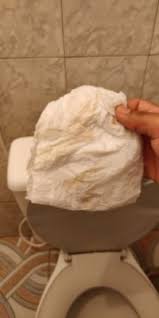 Ajuda Corrimento Rosado Minha Primeira Gravidez Babycenter