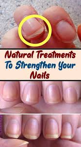 Natural Treatments To Strengthen Your Nails In 2020 How To Grow Nails Brittle Nails Treatment Strengthen Nails Naturally