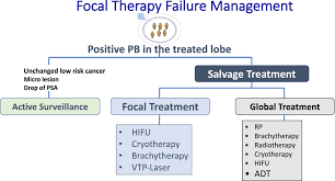Most medical organizations encourage men in their 50s to discuss the pros and cons of prostate cancer screening with their doctors. Management Options For Recurrent Prostate Cancer After First Line Focal Download Scientific Diagram
