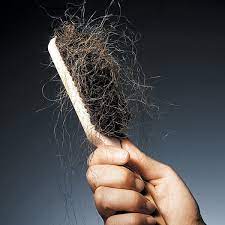 Rawatan tanam rambut atau hair transplant adalah solusi terakhir untuk mereka yang menghadapi. Rawatan Rambut Gugur Diary Of Muhammad