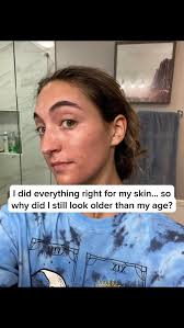 Same face, fresh start. One change turned everything around....🤯✨  #selfcare #healthylifestyle #nontoxic #beauty #reels