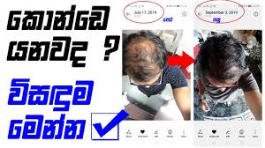 Keto Hair Loss Why Weight Loss Hair Loss Youtube