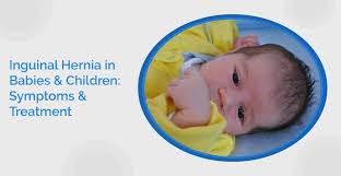 Image result for Inguinal hernia child