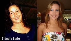 Resultado de imagem para antes e depois dos artistas brasileiros