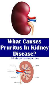 Pin On What Is Kidney Disease