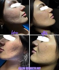 kalon Dermatology (@kalondermatology) • Instagram photos and videos