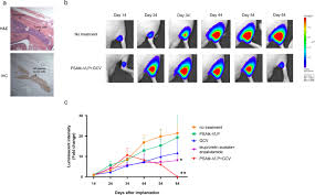 An androgen receptor inhibitor for treating advanced prostate cancer. Suppression Of Bone Metastatic Castration Resistant Prostate Cancer Cell Growth By A Suicide Gene Delivered By Jc Polyomavirus Like Particles Gene Therapy