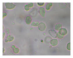 Image result for Dissotis brazzae