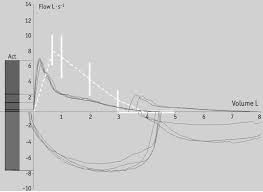 Spirometry Step By Step European Respiratory Society