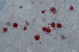 We did not find results for: Blood On The Floor Stock Photo Picture And Royalty Free Image Image 37573278