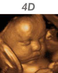 Pricing 3d Ultrasound And 4d Ultrasound Greensboro North Carolina
