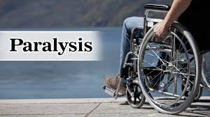 Image result for paralysis images